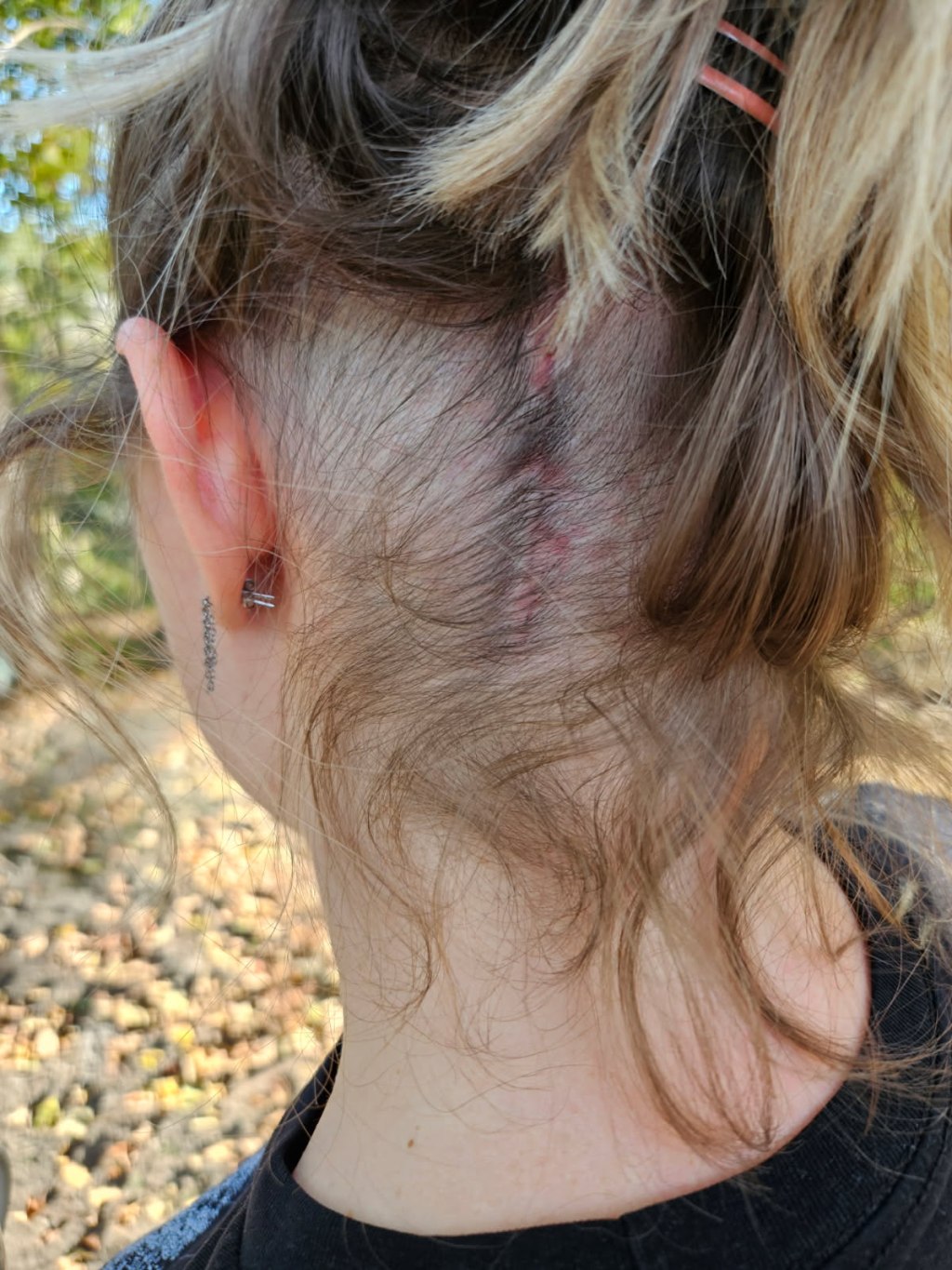 There Is War In My&nbsp;Bones